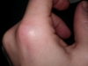 Sally\'s Knuckle